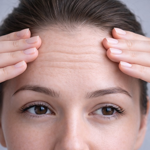 Fine lines visible on the forehead at rest